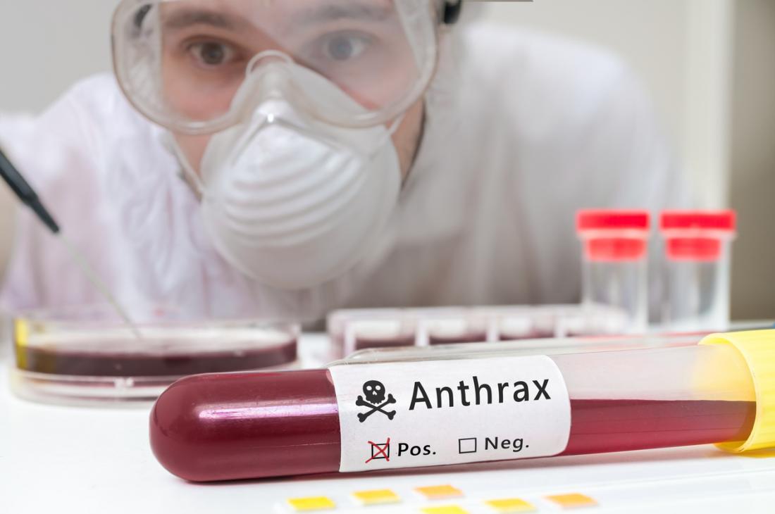 Anthrax-Infektion ist in den Vereinigten Staaten nicht üblich.