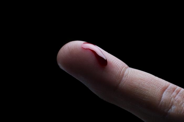 gota de sangue em um dedo]