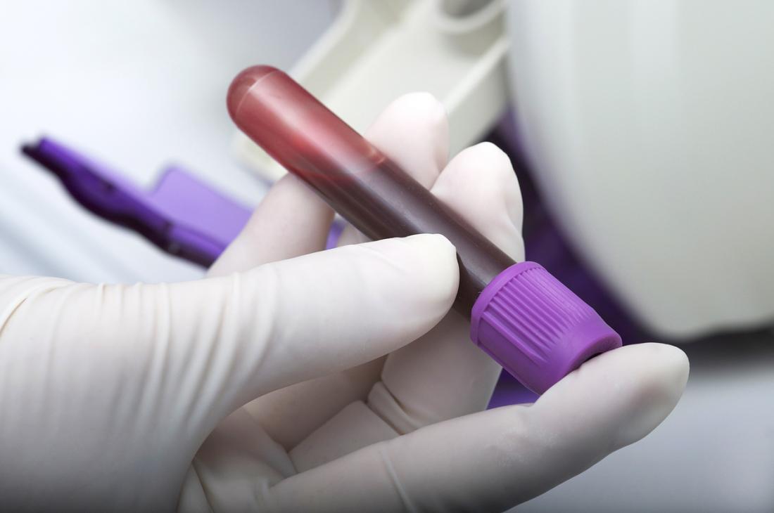 sangue no tubo de ensaio no laboratório