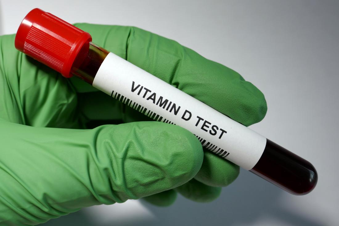 Analisi del sangue con vitamina D