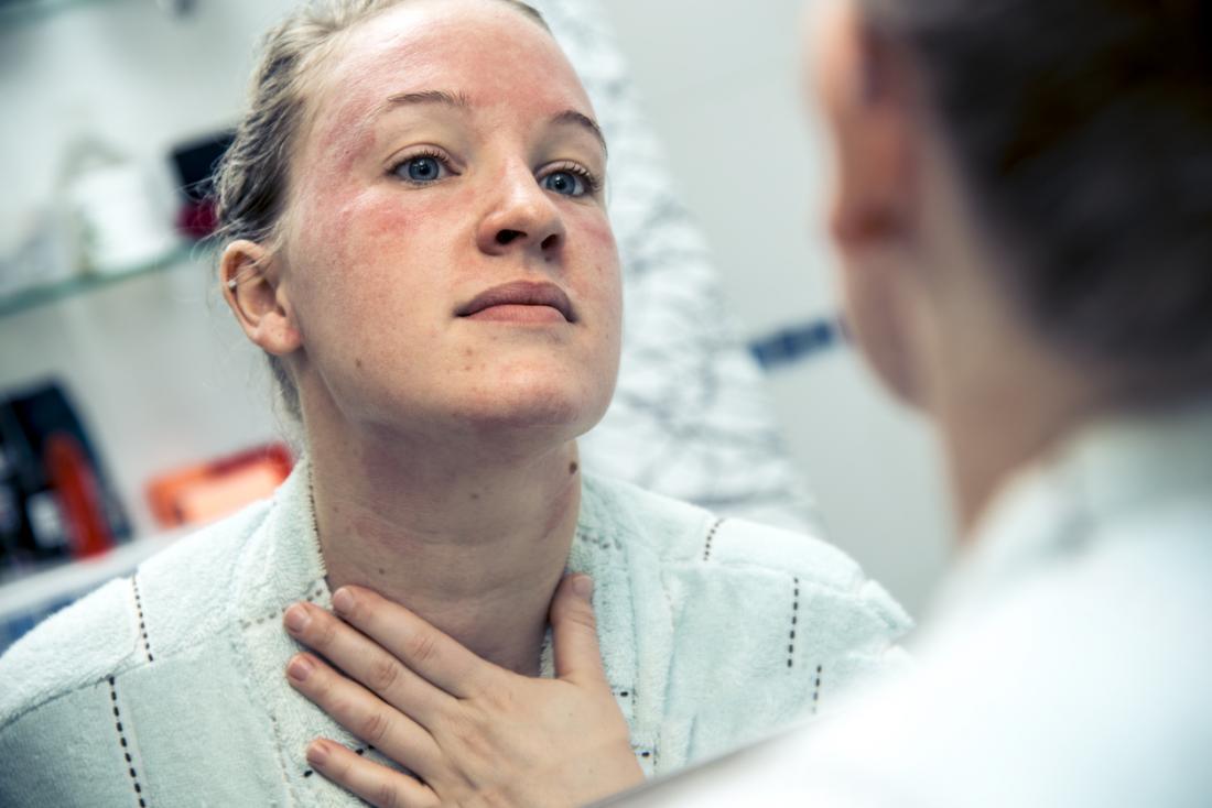 Frau, die in Badezimmerspiegel, mit rotem Hautausschlag auf ihrem Gesicht und Hals untersucht wird, verursachte durch eine allergische Reaktion.