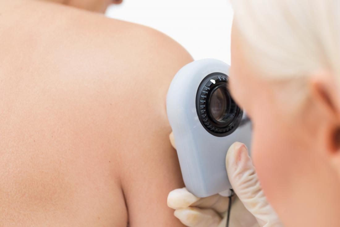 Dermatolog sprawdzający kreta na skórze osób chorych na raka