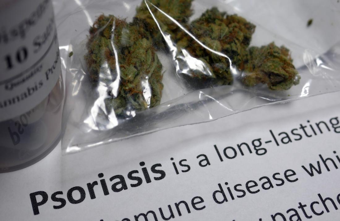 Cannabis für Psoriasis