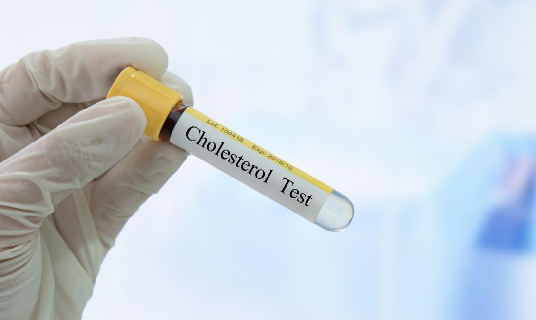 Cholesterin-Test