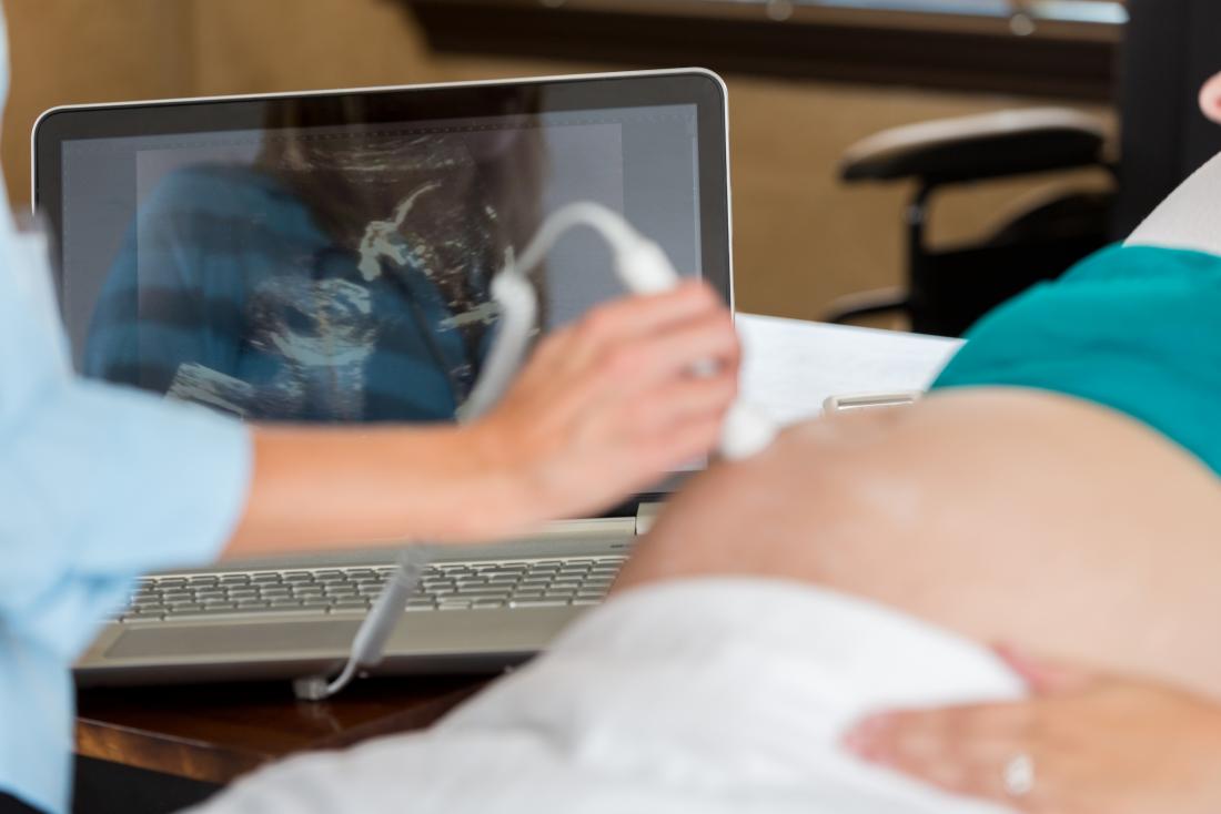 Ultraschallbild, das auf Babybild der schwangeren Frau auf Laptop durchgeführt wird
