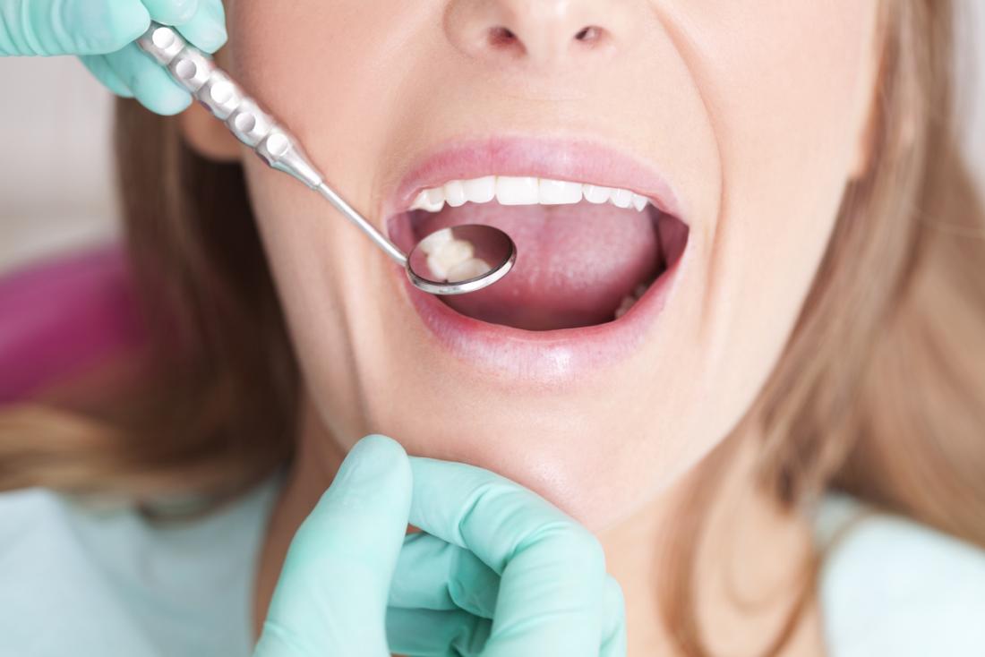 femme ayant ses dents vérifiées par un dentiste