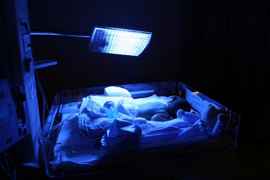 bebê com fototerapia
