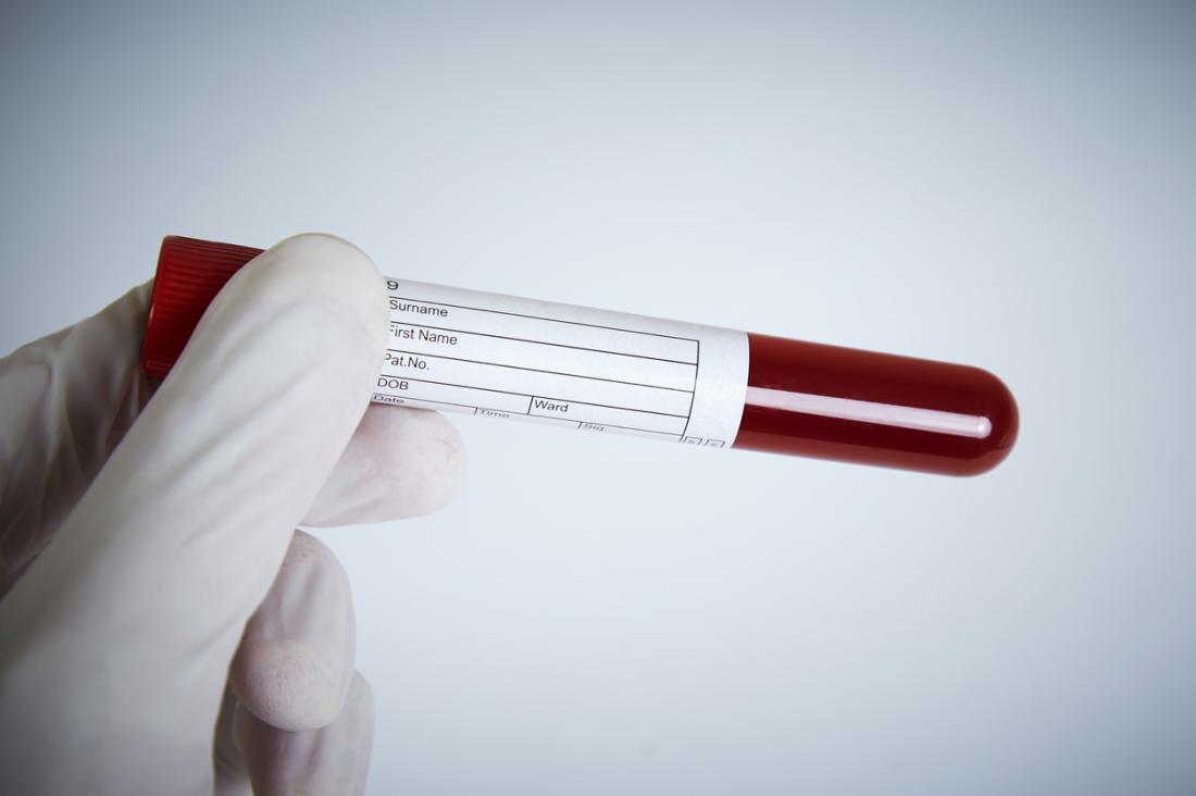 Um frasco de sangue sendo examinado em um laboratório por um cientista