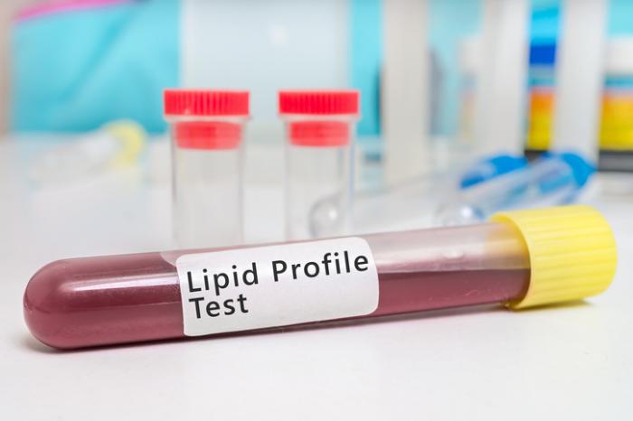 test del profilo lipidico