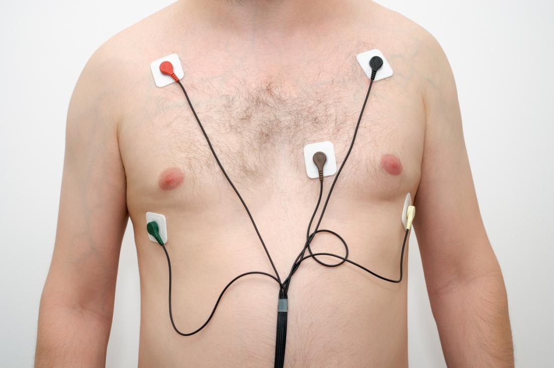 Mann trägt einen Holter-Monitor