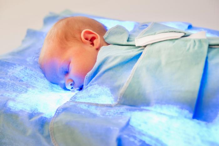 bebek fototerapi alma
