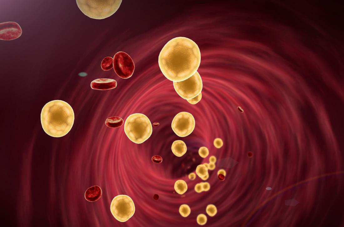 Células sanguíneas e partículas lipídicas na artéria para representar dislipidemia.