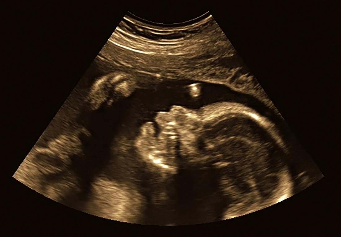 Ултразвуково сканиране на бебешки плод в утробата.