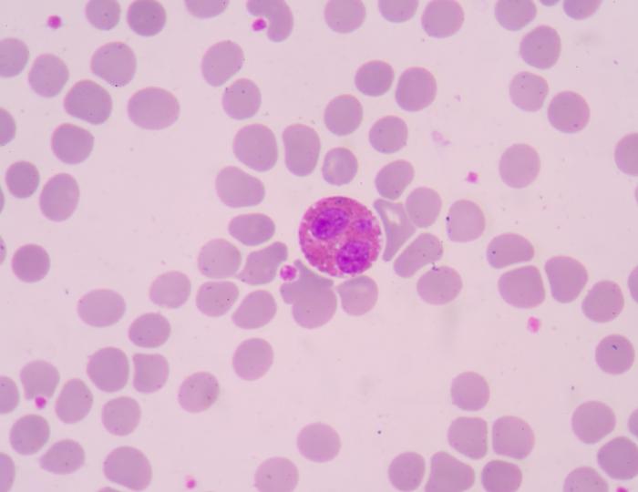 Immagine di un eosinofilo.