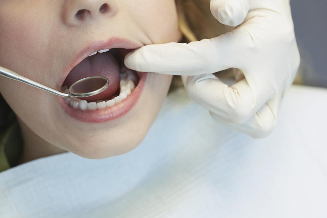 Dentista che ispeziona la bocca dei pazienti