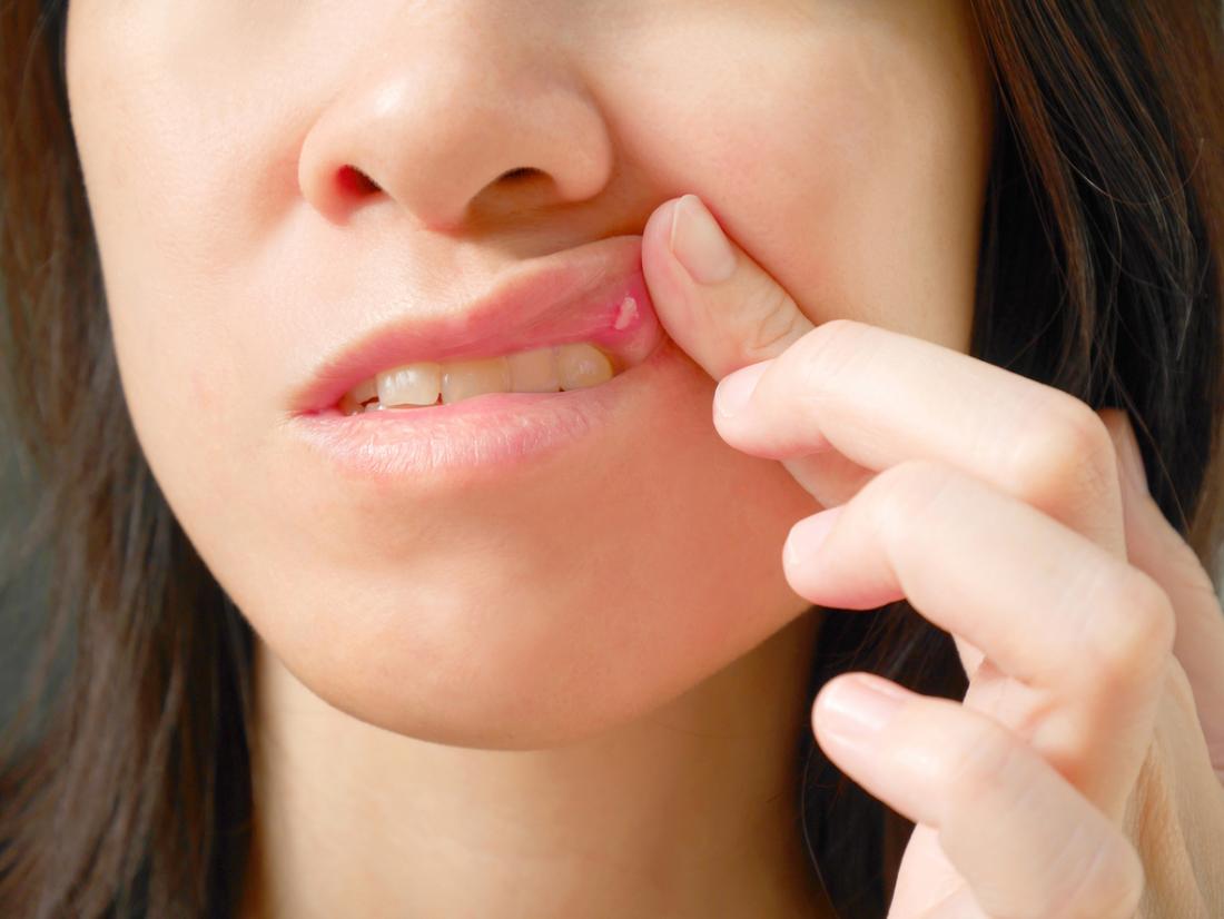 Closeup на устата на жената с рани болка