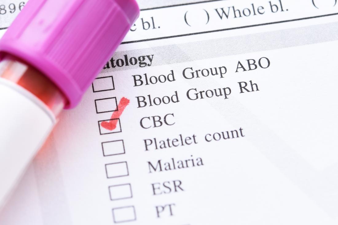 İnce kan için bir test tüpünde bir cbc testi
