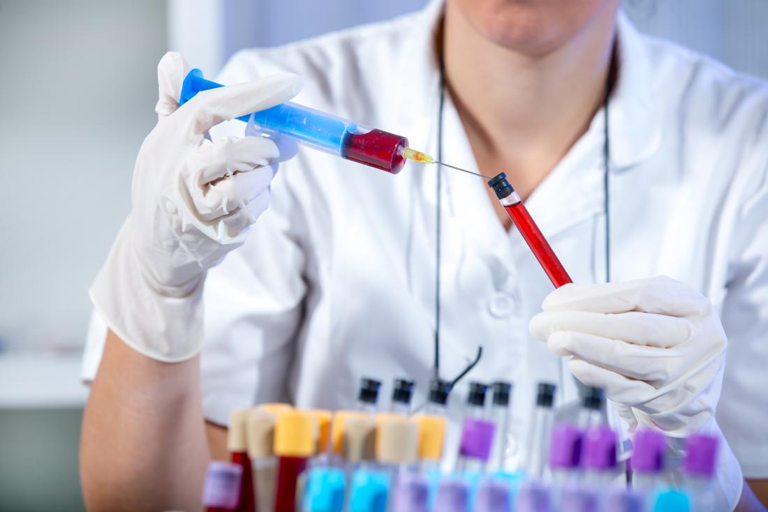 血液サンプルは技術者が検査室で検査のために移送する。