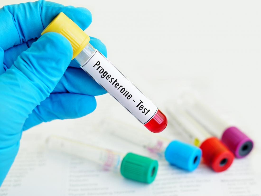 Test del progesterone in un testtuber. Può essere usato per verificare una breve fase luteale