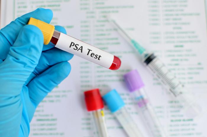Етикетиран PSA кръвен тест, който се държи с ръкавица
