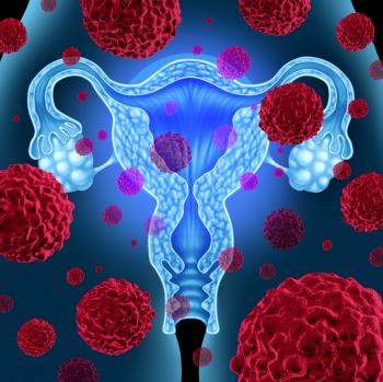 Immagine di utero, ovaie e cellule cancerose.
