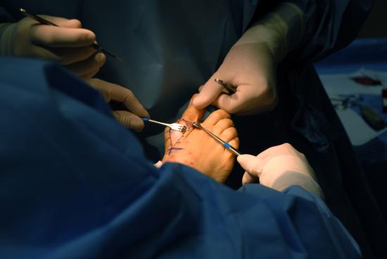 Medici che eseguono un intervento chirurgico al piede