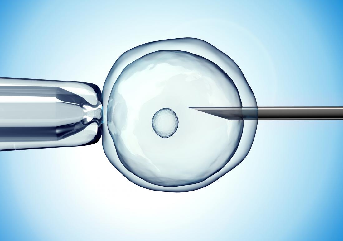 IVF се изобразява с яйце и игла.