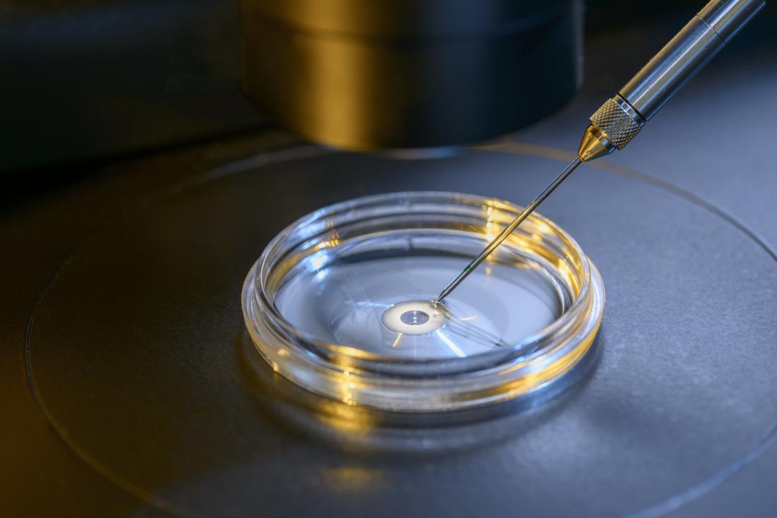 IVF liên quan đến việc bón phân trứng trong một món ăn trong phòng thí nghiệm.