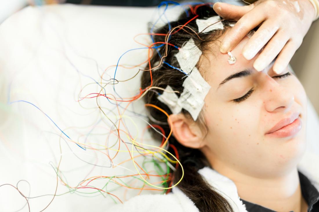 femme avec des électrodes attachées au crâne