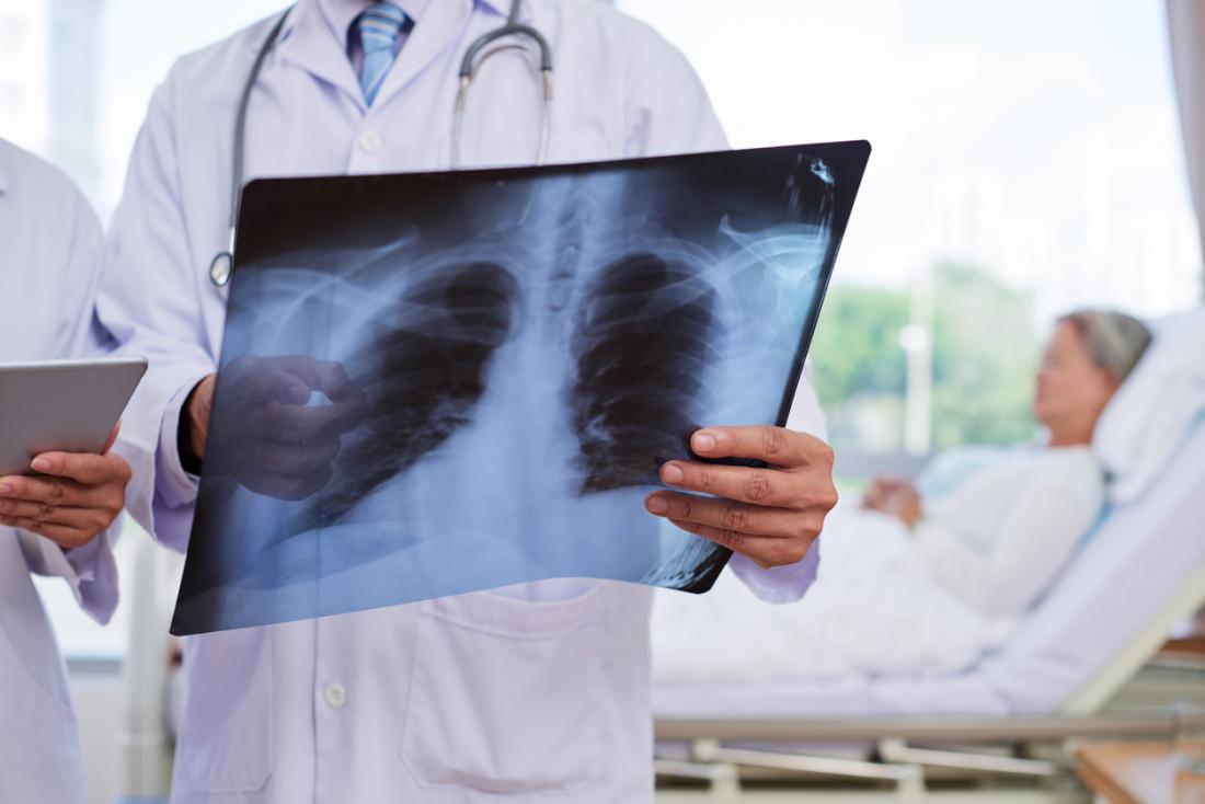 лекар, гледащ рентгенова снимка на белия дроб