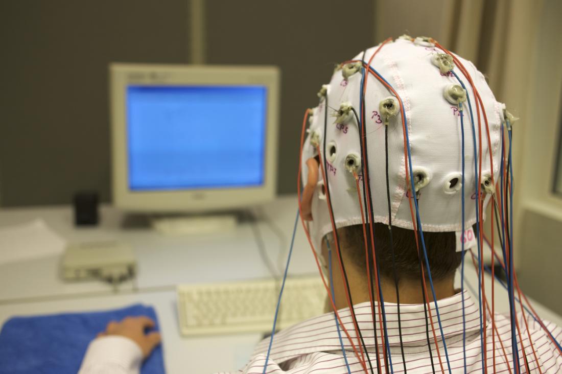 脳波（EEG）。