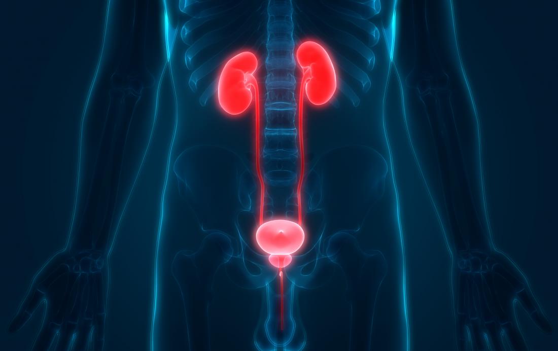 Dans le reflux vésico-urétéral, une valve défectueuse fait remonter l'urine vers les reins.