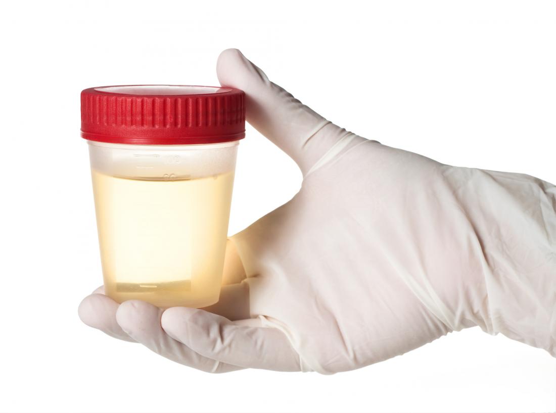 main gantée tenant un échantillon d'urine qui peut sentir l'ammoniaque