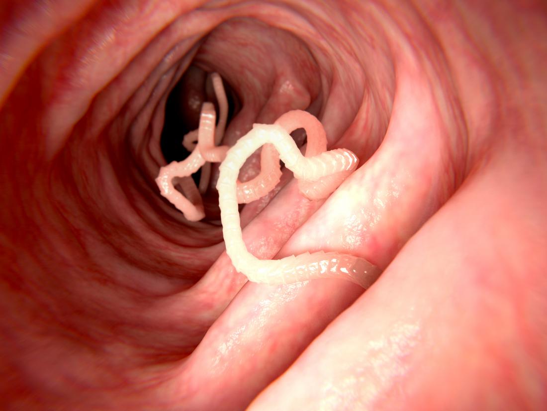 Ténia dans l'intestin peut causer des taches blanches dans les selles