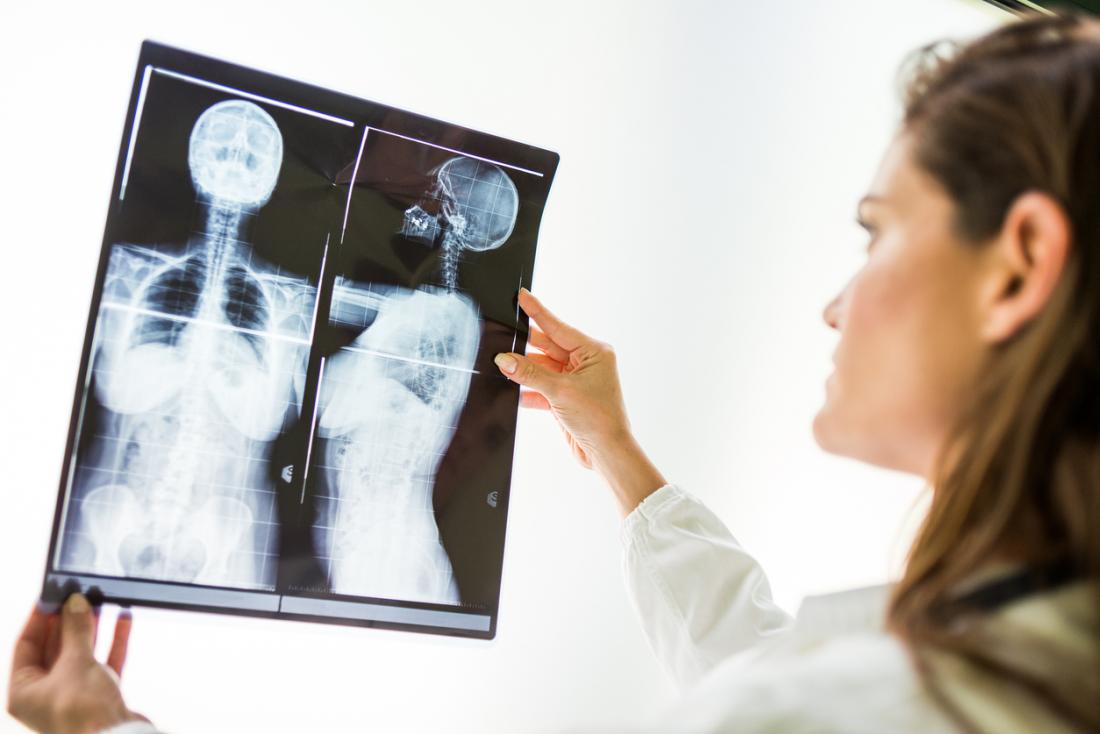 Untersuchungsbrust Röntgenstrahl des Doktors der Frau