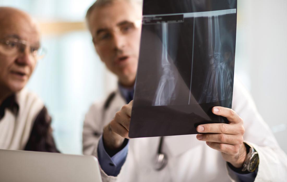 Spiral Fracture Treatment Options