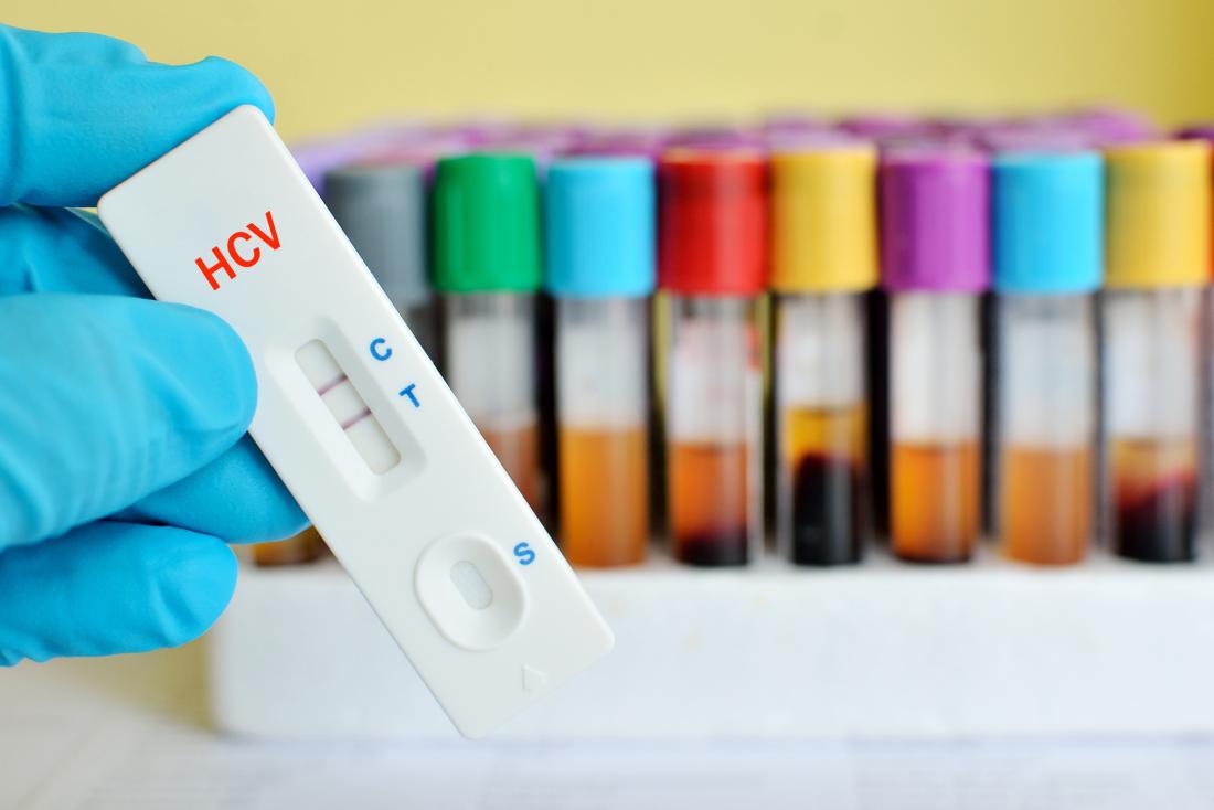 Тест за хепатит С пред кръвни проби.