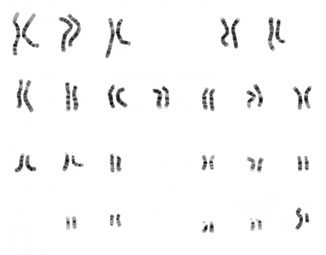 Karyotyp des Menschen männlich Bildnachweis: National Human Genome Research Institute