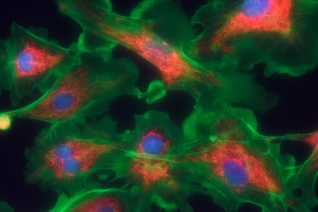 Cellules de fibroblastes en rendu 3D pour démontrer le fibrosarcome.