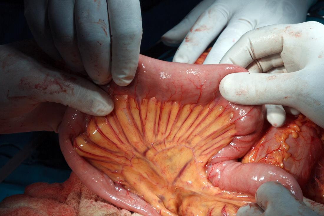 腸間膜