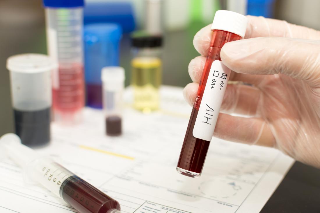Amostra de sangue em tubo para teste de HIV em laboratório.