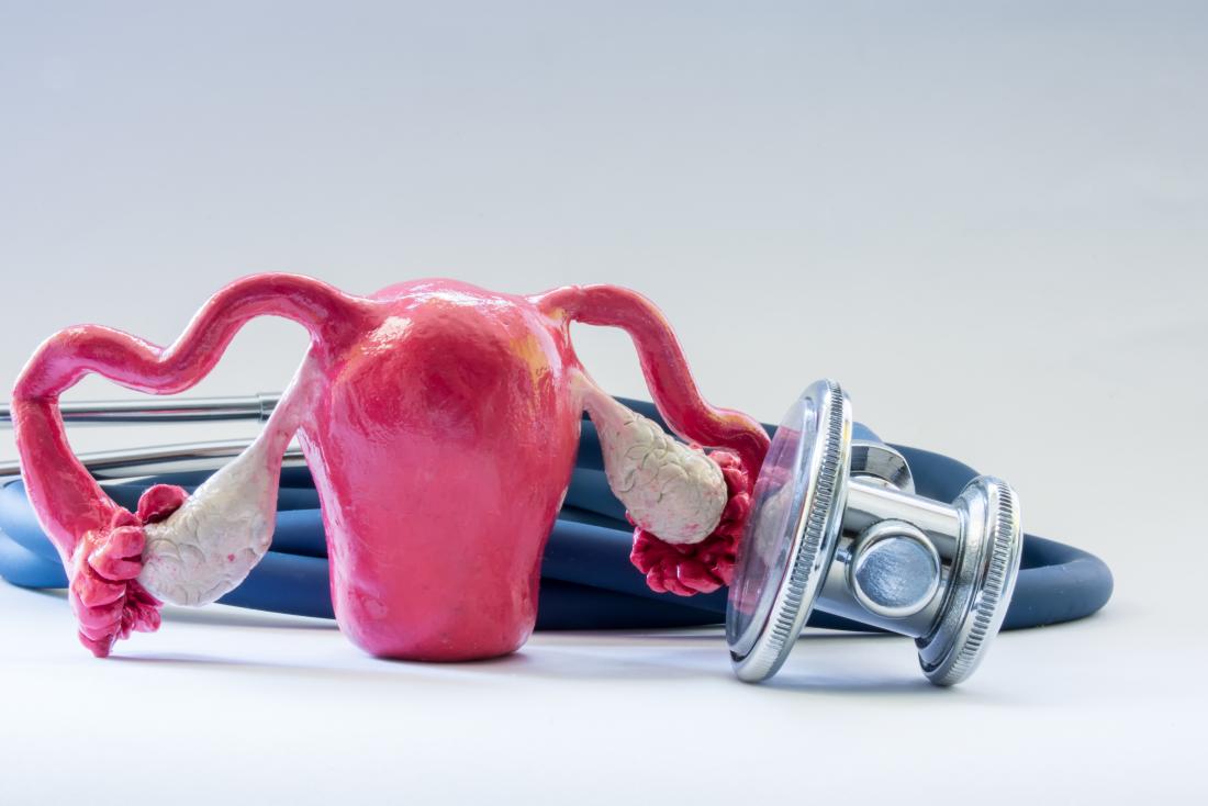 Modello di utero accanto allo stetoscopio che rappresenta l'adenomiosi