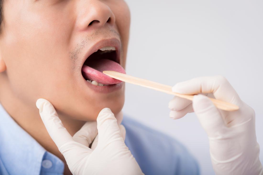 Medico che controlla la lingua e la gola del paziente.