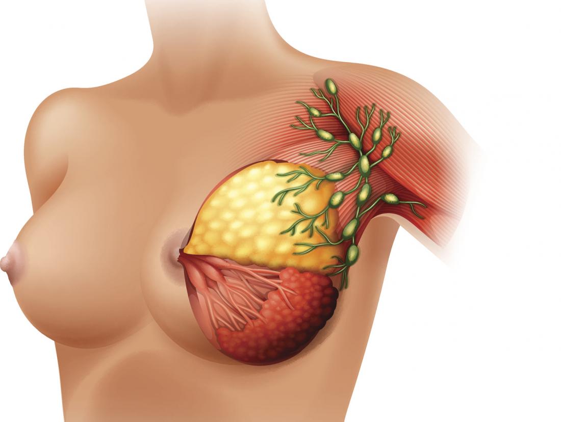 диаграма на гърдата, показваща лимфните възли
