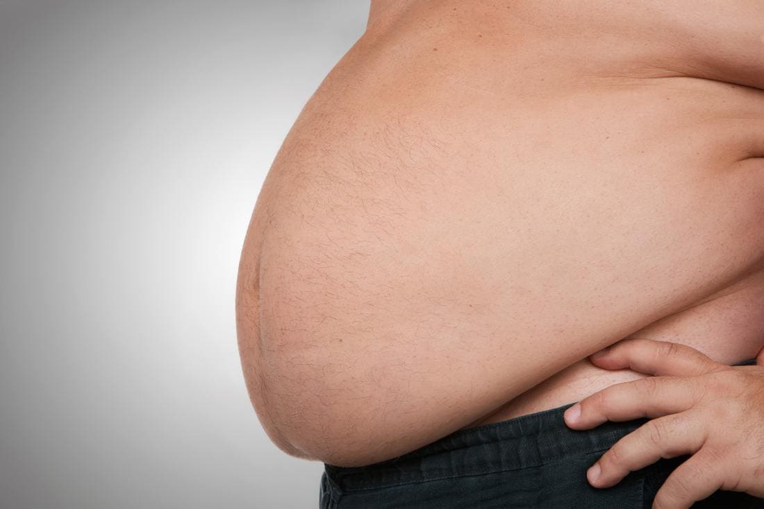 sehr großer männlicher Bauch