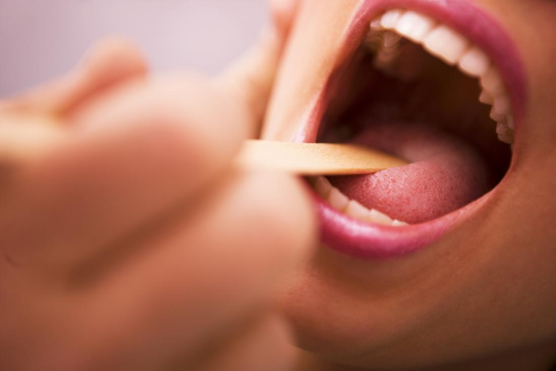 Pazienti con la lingua e la gola controllati,
