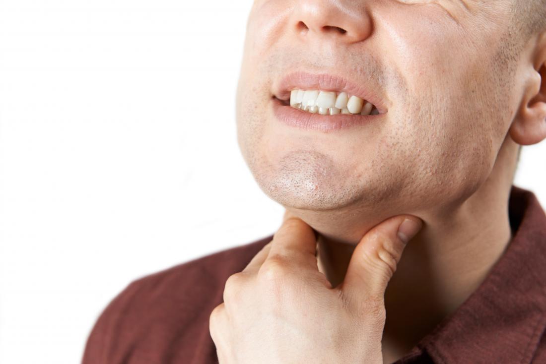 喉の潰瘍
