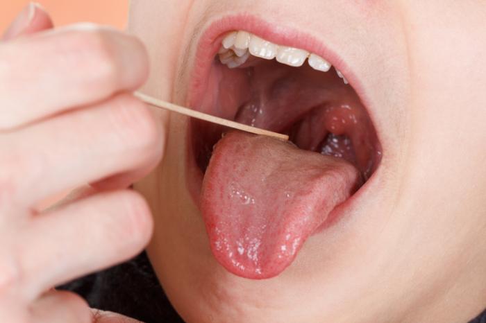 La bocca è controllata da un medico