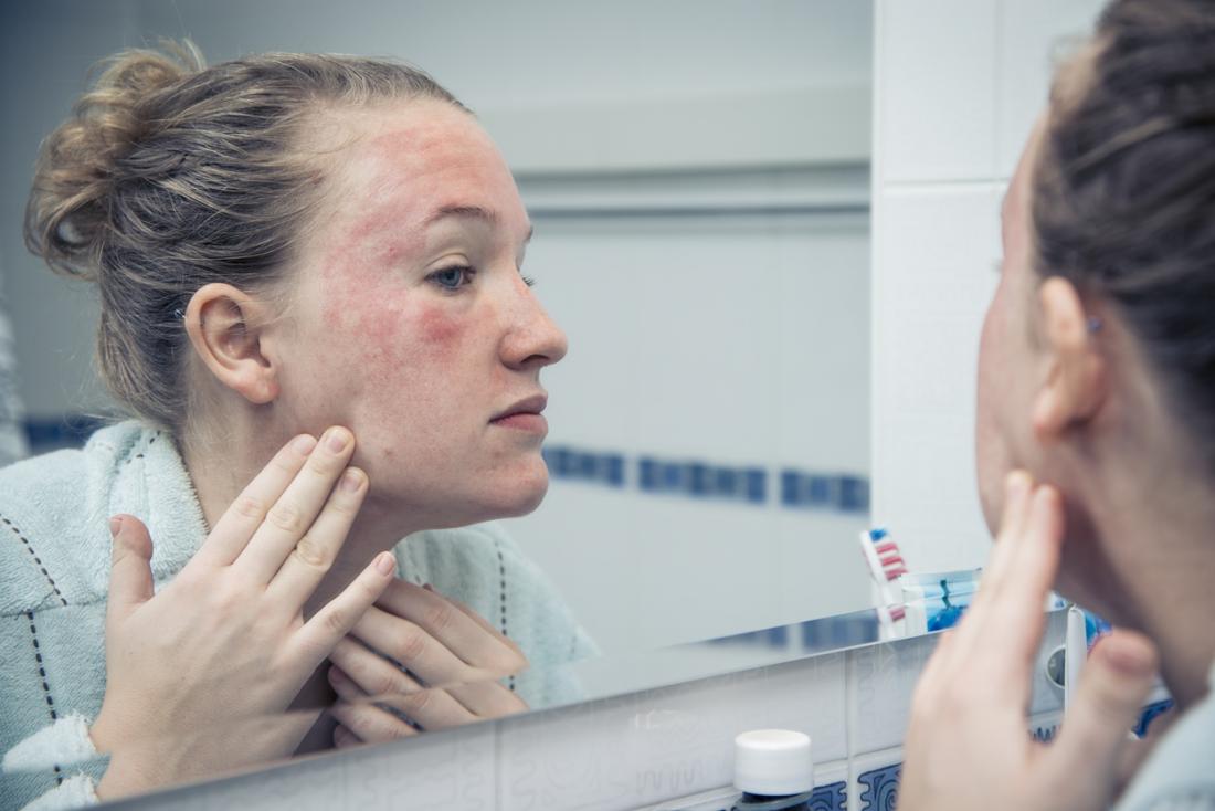 顔の発疹で鏡を見ている女性