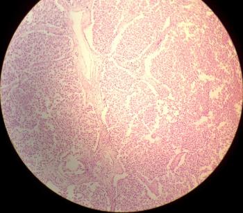 Микроскопичен изглед на семиномните клетки.